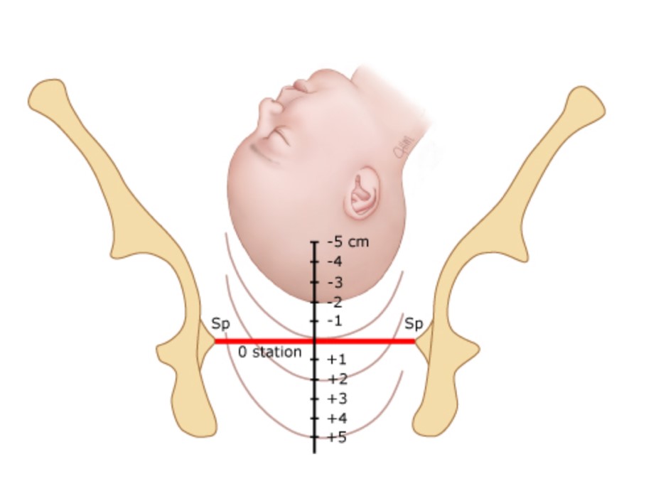 fetal station diagram